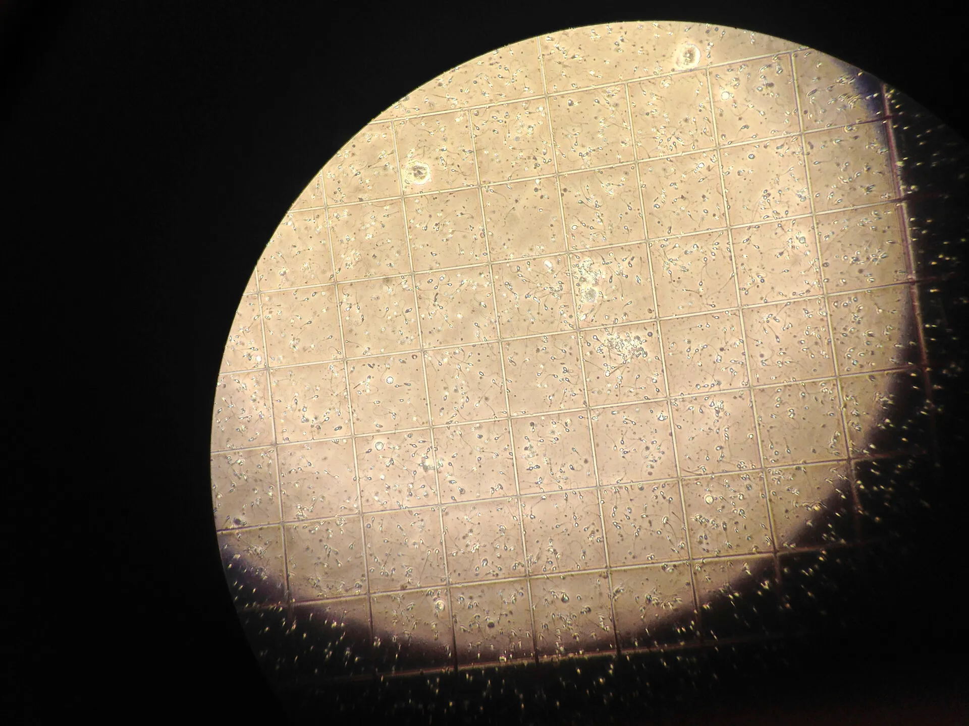 Nearly 100 children in Denmark conceived from sperm donor with increased cancer risk