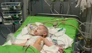 German pediatric heart device receives FDA okay