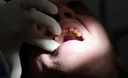 Dentist 'cut off own finger in fake robbery'
