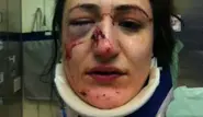 Munich officer broke woman's nose in cell